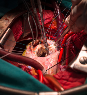 Χειρουργική τριγλώχινος και πνευμονικής βαλβίδος